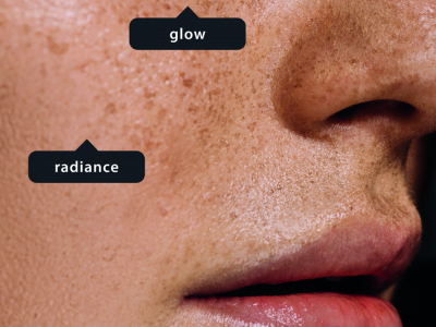 L’importance du diagnostic dans une prise en charge esthétique.