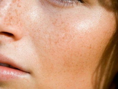 Quels soins pour ma peau en automne ?